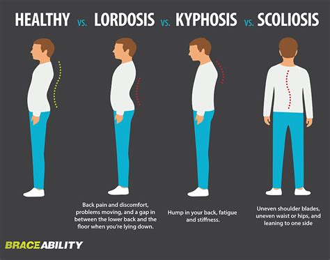 Is Running Good for Scoliosis? And Why Do Bananas Always Curve the Same Way?